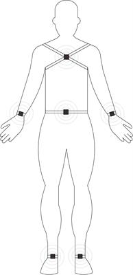 Detection of Motor Dysfunction With Wearable Sensors in Patients With Idiopathic Rapid Eye Movement Disorder